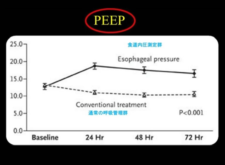 人工呼吸器設定と経肺圧 PEEP