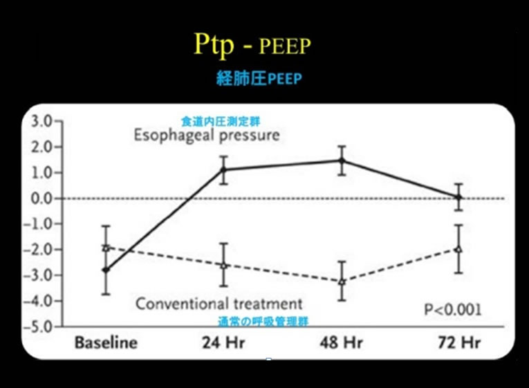 人工呼吸器設定と経肺圧 Ptp-PEEP