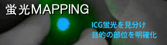 蛍光MAPPING ICG蛍光を見分け目的の部位を明確化